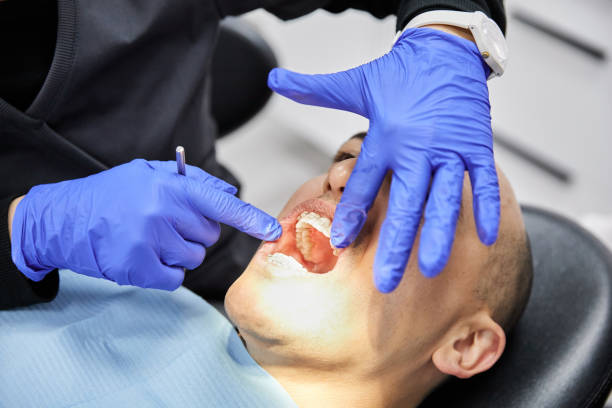 Best Dentist for Tooth Abscess  in Cuyahoga Falls, OH